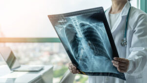 mesothelioma doctor