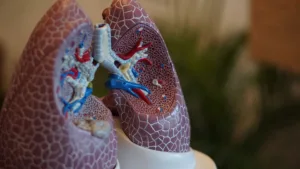 breath test mesothelioma